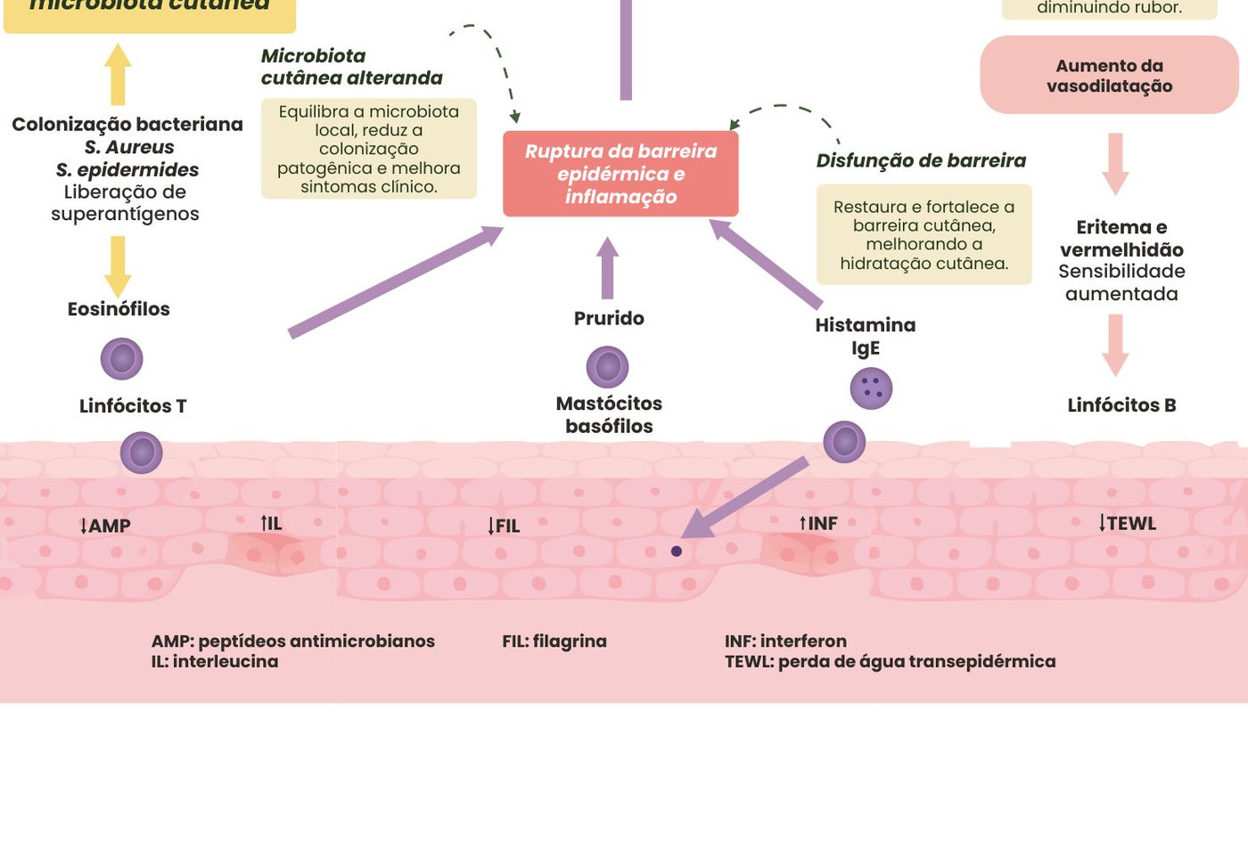 Figura 1: colonização bacteriana (S. aureus, S. epidermidis) altera a microbiota cutânea; eosinófilos, linfócitos T, mastócitos, basófilos e histamina/IgE levam à ruptura da barreira epidérmica e inflamação (IL-4, IL-5, IL-17, IL-22, substância P) e prurido; a desordem vascular aumenta a vasodilatação, com eritema, vermelhidão e sensibilidade; na pele há queda de peptídeos antimicrobianos, filagrina e aumento da perda de água transepidérmica; as fórmulas atuam no controle da inflamação, na microbiota, na barreira e na microcirculação